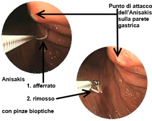 francescoquatraro_Anisakis-08